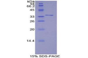 SDS-PAGE (SDS) image for TNF Receptor-Associated Factor 6 (TRAF6) (AA 153-423) protein (His tag) (ABIN2126981)