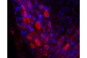 Expression of Galanin receptor 2 in rat DRG - Immunohistochemical staining of rat dorsal root ganglia (DRG) frozen sections using Anti-GALR2 Antibody (ABIN7043181, ABIN7044398 and ABIN7044399), (1:100).