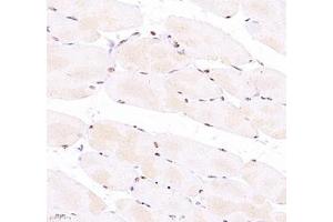 Immunohistochemistry of paraffin embedded mouse Skeletal muscle using Troponin I (ABIN7076031) at dilution of 1:700 (400x lens)