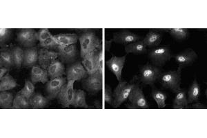 Immunofluorescent staining of A549 (ATCC CCL-185) cells. (NF-kB p65 anticorps  (AA 136-224))