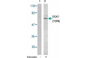 Western blot analysis of extracts from K-562 cells using DOK1 (phospho Y398) polyclonal antibody . (DOK1 anticorps  (pTyr398))