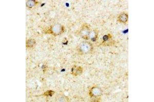 Immunohistochemical analysis of Transcobalamin-2 staining in mouse brain formalin fixed paraffin embedded tissue section. (TCN2 anticorps)