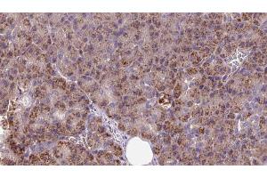 ABIN6273256 at 1/100 staining Human pancreas cancer tissue by IHC-P. (INSIG1 anticorps  (Internal Region))