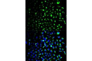 Immunofluorescence analysis of U2OS cells using HK1 antibody.