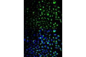 Immunofluorescence analysis of U2OS cells using HK1 antibody.