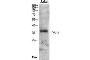 Western Blot (WB) analysis of specific cells using PAI-1 Polyclonal Antibody. (PAI1 anticorps  (Internal Region))
