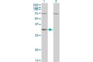 Western Blot analysis of SDR16C5 expression in transfected 293T cell line by RDHE2 monoclonal antibody (M01), clone 3G8. (SDR16C5 anticorps  (AA 26-309))