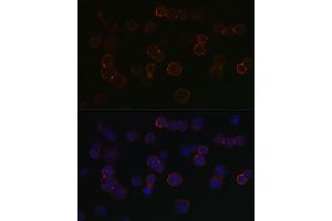 Immunofluorescence analysis of SP2/0 cells using TNFRSF17 Rabbit pAb (ABIN7271066) at dilution of 1:150 (40x lens).