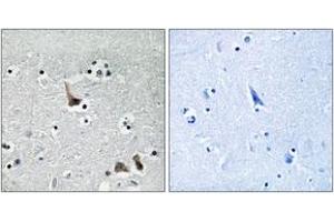 Immunohistochemistry (IHC) image for anti-ATPase, H+ Transporting, Lysosomal 50/57kDa, V1 Subunit H (ATP6V1H) (AA 341-390) antibody (ABIN2890686) (ATP6V1H anticorps  (AA 341-390))