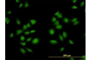 Immunofluorescence of monoclonal antibody to AKAP13 on HeLa cell. (AKAP13 anticorps  (AA 1-110))