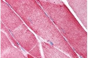 Human Skeletal Muscle (formalin-fixed, paraffin-embedded) stained with VDAC2 antibody ABIN213732 at 2.