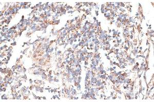 Immunohistochemistry of paraffin-embedded Human tonsil using KATNA1 Polyclonal Antibody at dilution of 1:100 (40x lens). (KATNA1 anticorps)