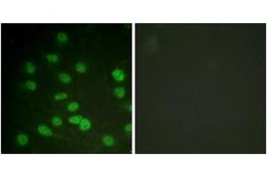 Immunofluorescence analysis of HuvEc cells treated with serum 20% 30', using DDX3/DEAD-box Protein 3 (Phospho-Thr322) Antibody. (DDX3 anticorps  (pThr322))