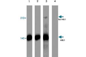 Western blot analysis of K-562 cells treated with pervanadate (1 mM) for 30 minutes (lanes 1 & 3). (ABL1 anticorps  (pTyr245))