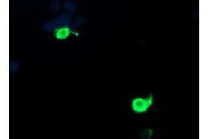 Image no. 3 for anti-Proteasome (Prosome, Macropain) Inhibitor Subunit 1 (PI31) (PSMF1) antibody (ABIN1500490)