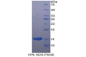SDS-PAGE analysis of Human Agouti Related Protein. (AGRP Protéine)