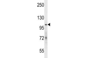 hGCN5 antibody western blot analysis in mouse Neuro-2a lysate.