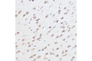 Immunohistochemistry of paraffin-embedded mouse brain using UFM1 Rabbit pAb (ABIN7271184) at dilution of 1:300 (40x lens). (UFM1 anticorps  (AA 1-85))