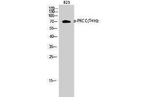 Western Blotting (WB) image for anti-Protein Kinase C, zeta (PRKCZ) (pThr410) antibody (ABIN3179493) (PKC zeta anticorps  (pThr410))