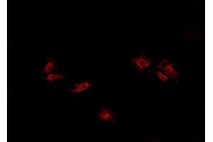 ABIN6269088 staining HeLa cells by IF/ICC. (ATP1A1 anticorps  (N-Term))