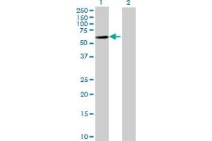 Western Blot analysis of IGHA2 expression in transfected 293T cell line by IGHA2 MaxPab polyclonal antibody. (IGHA2 anticorps  (AA 1-477))