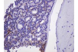 Image no. 2 for anti-Carbonic Anhydrase 12 (CA12) antibody (ABIN1497067)