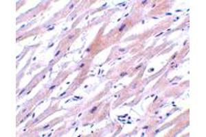 Immunohistochemistry of UNG in human heart tissue with UNG polyclonal antibody  at 2 ug/mL . (UNG anticorps  (N-Term))