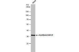 WB Image Whole cell extract (30 μg) was separated by 10% SDS-PAGE, and the membrane was blotted with Apolipoprotein E antibody , diluted at 1:1000. (APOE anticorps  (N-Term))