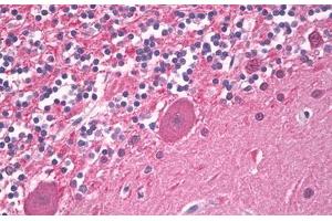 Image no. 1 for anti-Ubiquitin Carboxyl-terminal Esterase L1 (Ubiquitin Thiolesterase) (UCHL1) antibody (ABIN1502308)