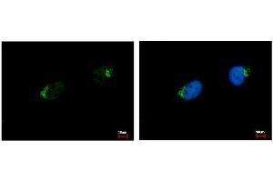 ICC/IF Image GALNT7 antibody [N1C2] detects GALNT7 protein at Golgi apparatus by immunofluorescent analysis. (GALNT7 anticorps  (Center))
