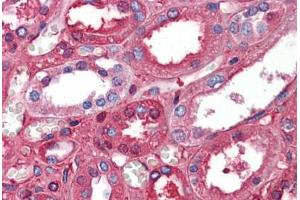 Human Kidney: Formalin-Fixed, Paraffin-Embedded (FFPE) (Albumin anticorps  (AA 108-157))