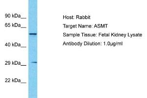 Host: Rabbit Target Name: ASMT Sample Tissue: Human Fetal Kidney Antibody Dilution: 1ug/ml (ASMT anticorps  (N-Term))