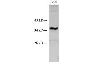 Western Blot analysis of A431 cell using C15orf23 Polyclonal Antibody at dilution of 1:500 (KNSTRN anticorps)