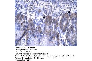 Human Stomach (OTX2 anticorps  (N-Term))