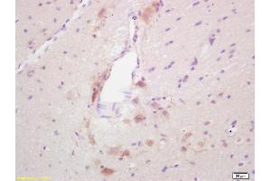 Formalin-fixed and paraffin embedded rat brain labeled with Rabbit Anti GAD65 Polyclonal Antibody, Unconjugated (ABIN668140) at 1:200 followed by conjugation to the secondary antibody and DAB staining (GAD65 anticorps  (AA 501-585))