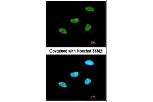 ICC/IF Image Immunofluorescence analysis of paraformaldehyde-fixed HeLa, using MEF2A, antibody at 1:200 dilution.