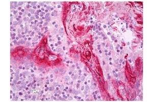 Tonsil stained with TGM1 antibody Cat.