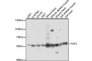 Western blot analysis of extracts of various cell lines, using PDP1 antibody (ABIN7269774) at 1:3000 dilution. (PDP anticorps  (AA 72-260))
