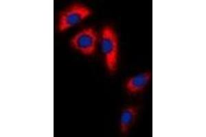 Immunofluorescent analysis of Aconitase 1 staining in Hela cells.