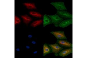 ABIN6264551 and ABIN6272407 staining  cells by IF/ICC.
