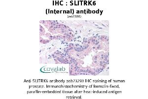 Image no. 2 for anti-SLIT and NTRK-Like Family, Member 6 (SLITRK6) (Internal Region) antibody (ABIN1739441) (SLITRK6 anticorps  (Internal Region))