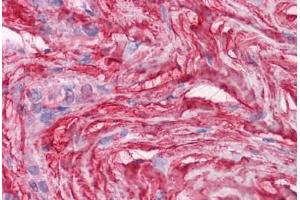 Human Soft tissue: Formalin-Fixed, Paraffin-Embedded (FFPE)