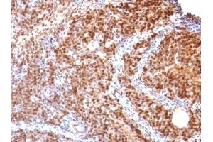 Formalin-fixed, paraffin-embedded Rat Ovary stained with SUMO-2 MAb (SUMO2/1199) (SUMO2 anticorps)