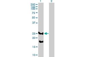 Western Blot analysis of REEP2 expression in transfected 293T cell line by REEP2 MaxPab polyclonal antibody. (REEP2 anticorps  (AA 1-252))