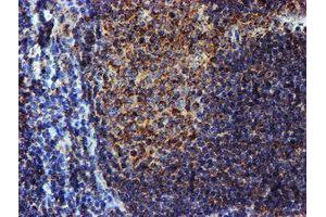 Image no. 12 for anti-NADH Dehydrogenase (Ubiquinone) 1 beta Subcomplex, 9, 22kDa (NDUFB9) (AA 3-179) antibody (ABIN1491359)