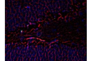 Immunofluorescence (IF) image for anti-Tubulin, beta 3 (TUBB3) antibody (ABIN371847) (TUBB3 anticorps)