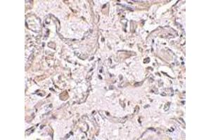 Immunohistochemical staining of human lung tissue using AP30389PU-N GSTP1 antibody at 2. (GSTP1 anticorps  (Center))