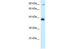 Western Blot showing TAGAP antibody used at a concentration of 1 ug/ml against Fetal Liver Lysate (TAGAP anticorps  (N-Term))