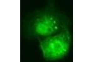 Anti-C21orf59 mouse monoclonal antibody (ABIN2452866) immunofluorescent staining of COS7 cells transiently transfected by pCMV6-ENTRY C21orf59 (RC200169). (C21orf59 anticorps)