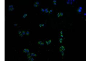 Immunofluorescence staining of Hela cells with ABIN7146439 at 1:100, counter-stained with DAPI. (CAMK2A anticorps  (AA 321-478))